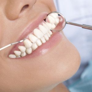 bonding Cosmetic Dentist in Oklahoma City